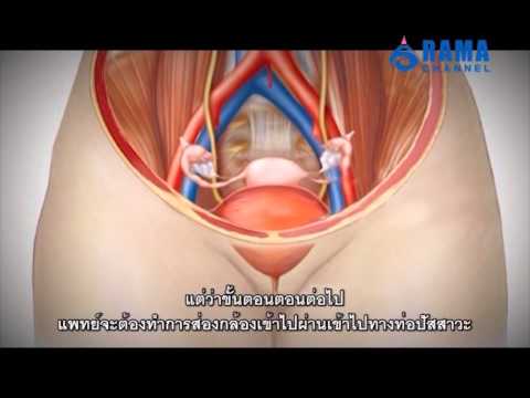 ทุกอย่างที่เกี่ยวกับยาเสพติดค้อนของ ธ อร์ ซื้อเชื้อโรคม้า vetapteki