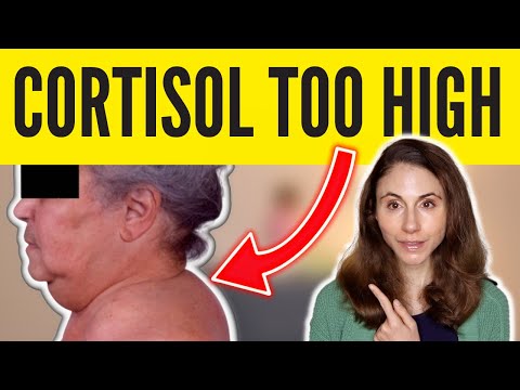 Is Your Cortisol High? Look for These 8 Signs