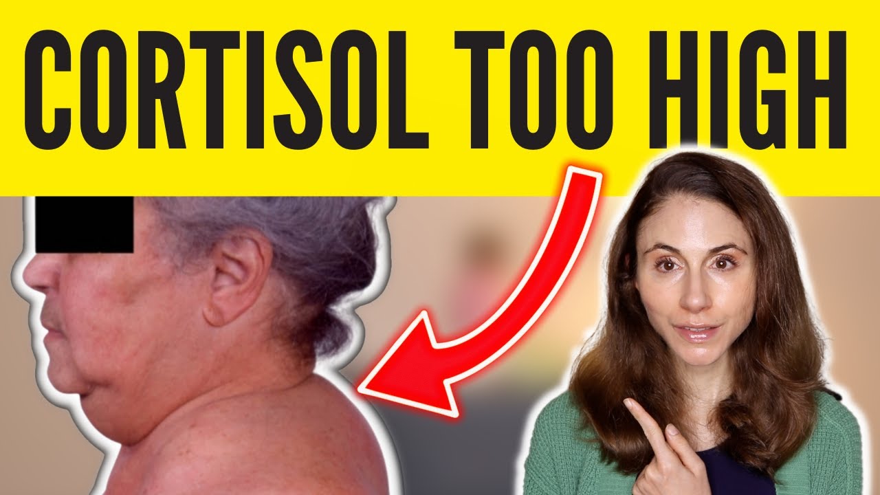 8 SIGNS OF HIGH CORTISOL *SKIN & HAIR* @DrDrayzday