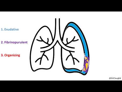 Empyema and Pleural Effusions