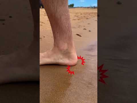 لا تركض على الشاطئ