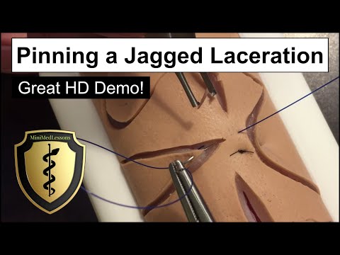 SUTURE Tutorial: Vertical Mattress Pinning Jagged Laceration - Step-by-step instructions!