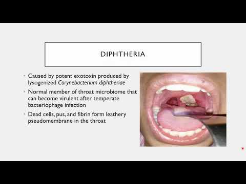 BIO 205 - Chapter 22 - Respiratory Infections