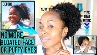 How to Get Rid of Bloated Face, Double Chin, Puffy Eyes & Face Fat FAST & NATURALLY