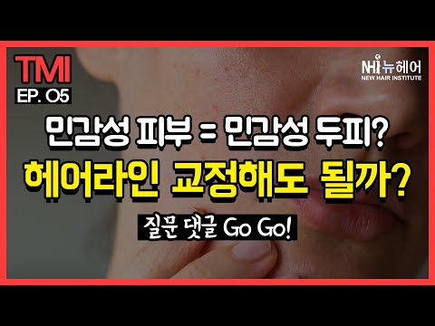 민감한 여성 피부에 모발이식을 한다면... l 헤어라인교정 I 뉴헤어 I 헤어라인