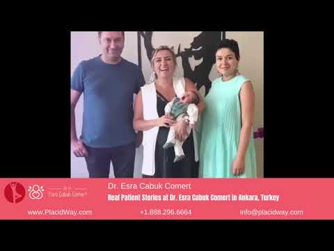 Dr. Esra Cabuk Comert in Ankara, Turkey - Patient Story Compilations