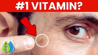 Top 3 nutrients to REMOVE age spots