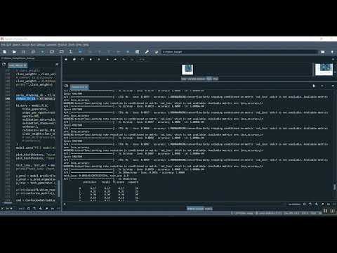 Pill Detection Train CNN Flask App in Python Projects