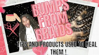 Bumps From Braids