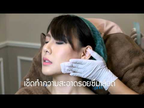 ที่มีหน้าอกหัวนมเล็ก ๆ ผมไม่ได้ทำร้าย mammoplasty เต้านม