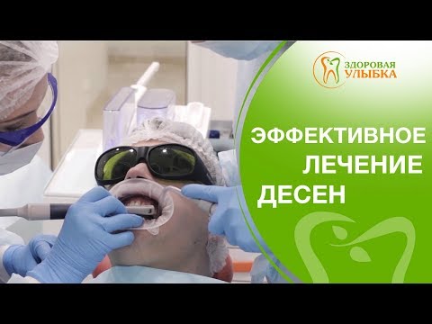 Лечение десен аппаратом Vector. 🌞 Безболезненное лечение десен аппаратом Vector. 12+