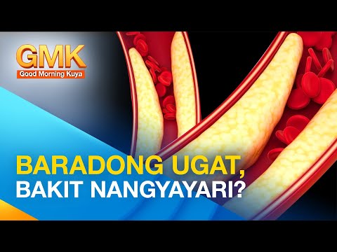 Alamin kung bakit nagkakaroon ng baradong ugat | Now You Know