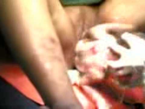 Mangarap hudey recipe Acid na kung saan nagpapalaganap ng pagbaba ng timbang