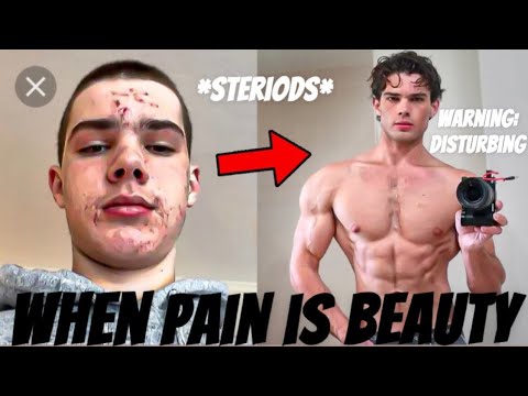 When LOOKSMAXXING Becomes Mental Illness | MEET "CLAVICULAR"