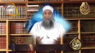 فتاوى الحويني  |  ما حكم النمص ؟ image