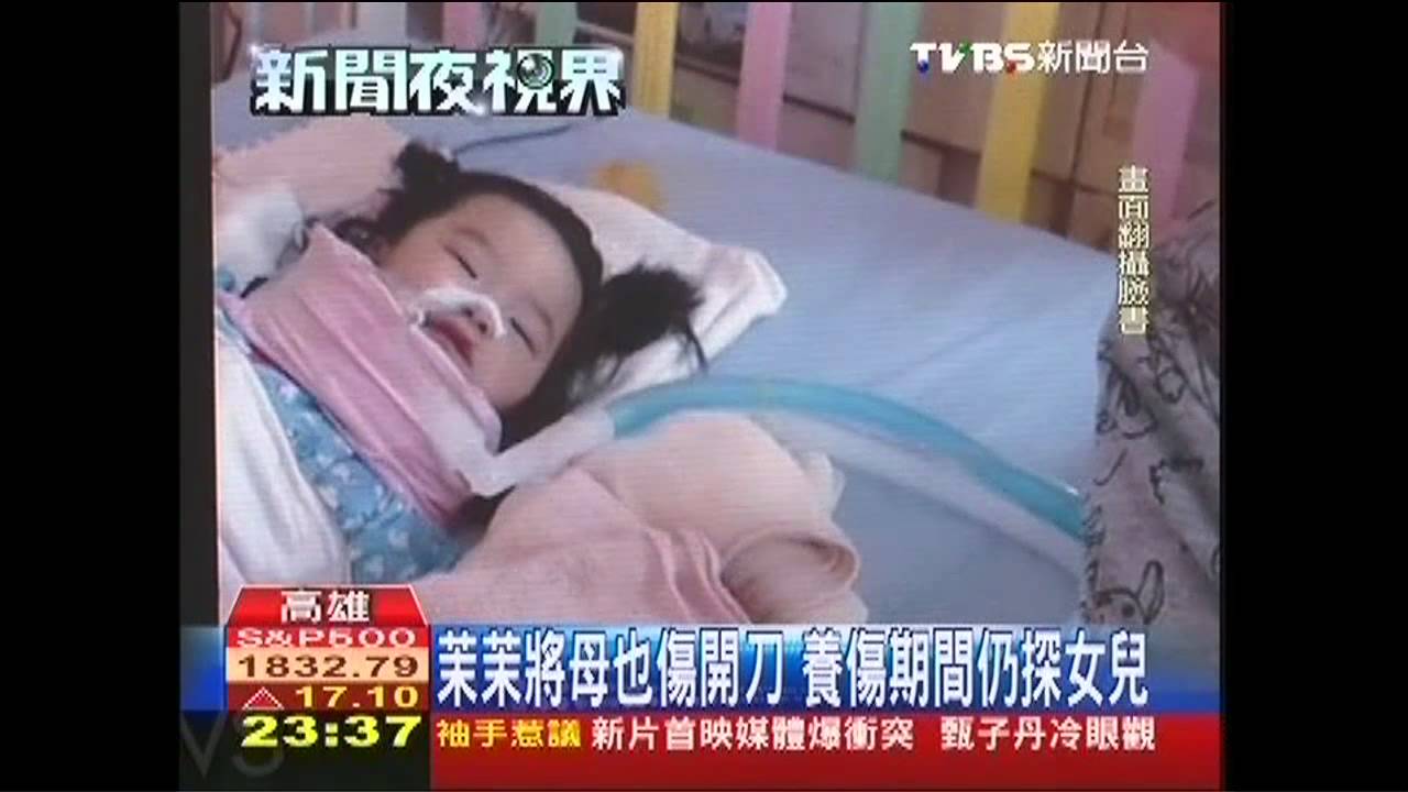 珣珣翻版! 1.5歲「茉茉將」車禍癱FB集氣