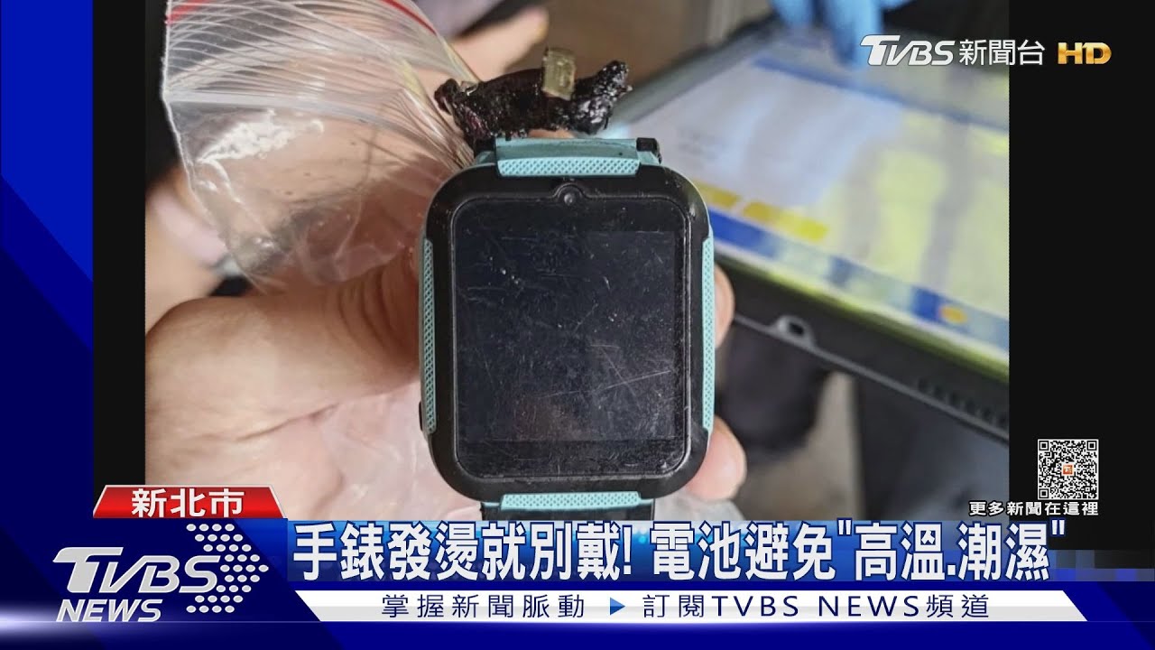 悚！智慧定位錶爆炸童手遭火灼　恐植皮