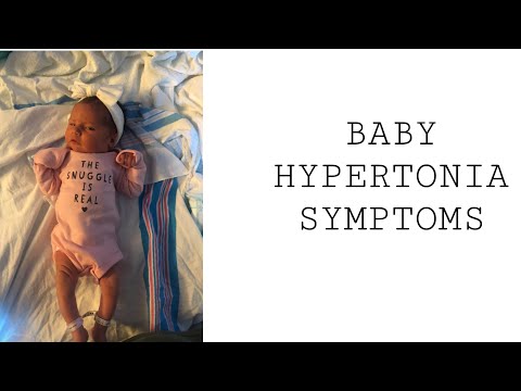 Baby Hypertonia Symptoms