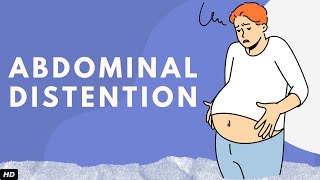 Abdominal Distention: Everything You Need To Know