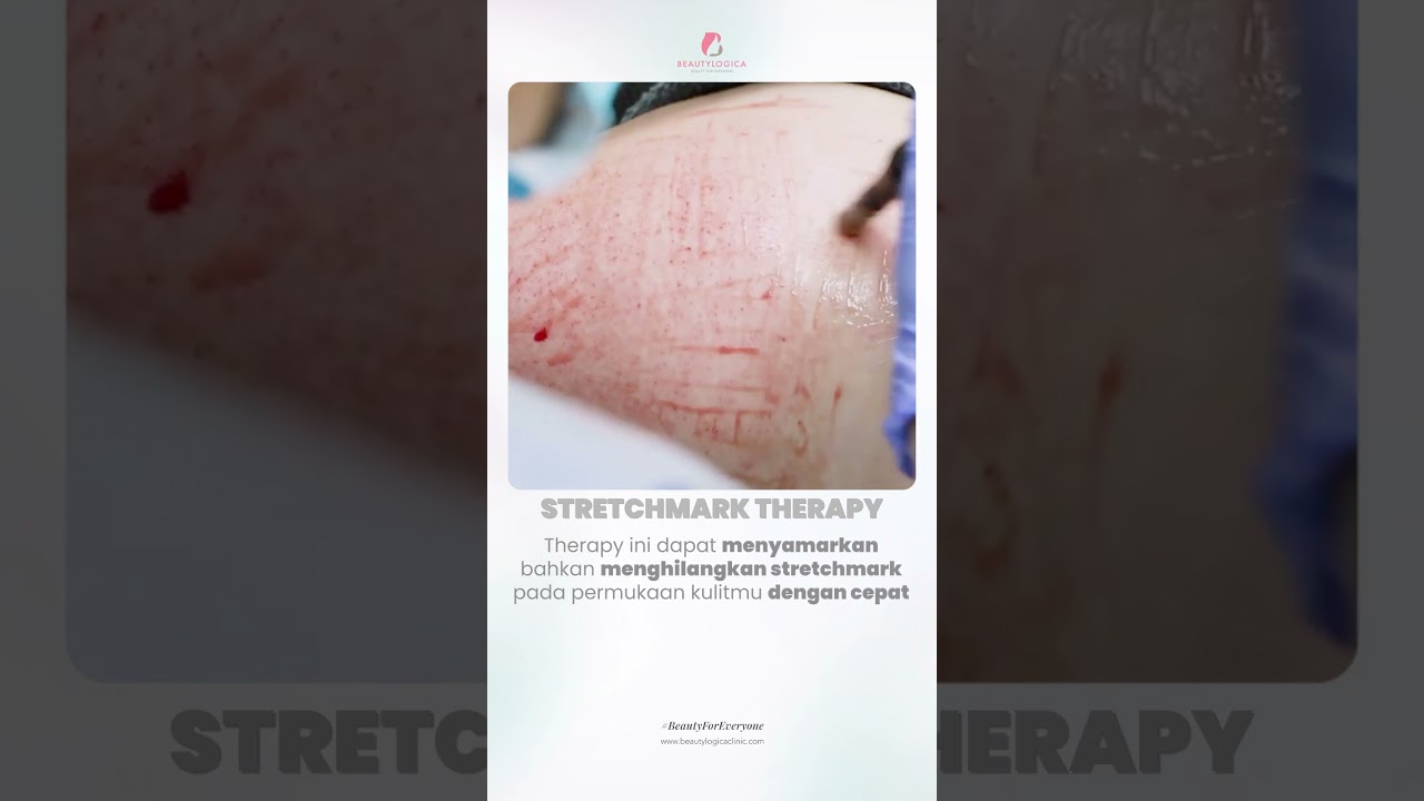 Video Shorts Beautylogica Clinic