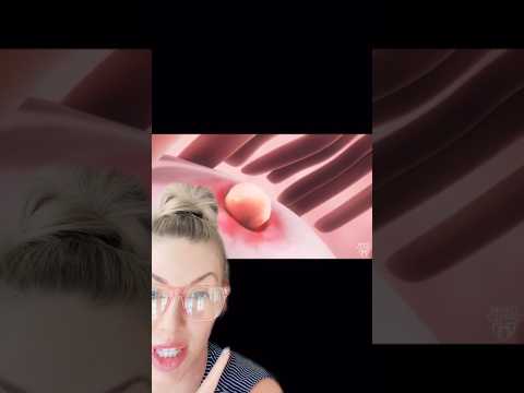 Backache And Ovulation