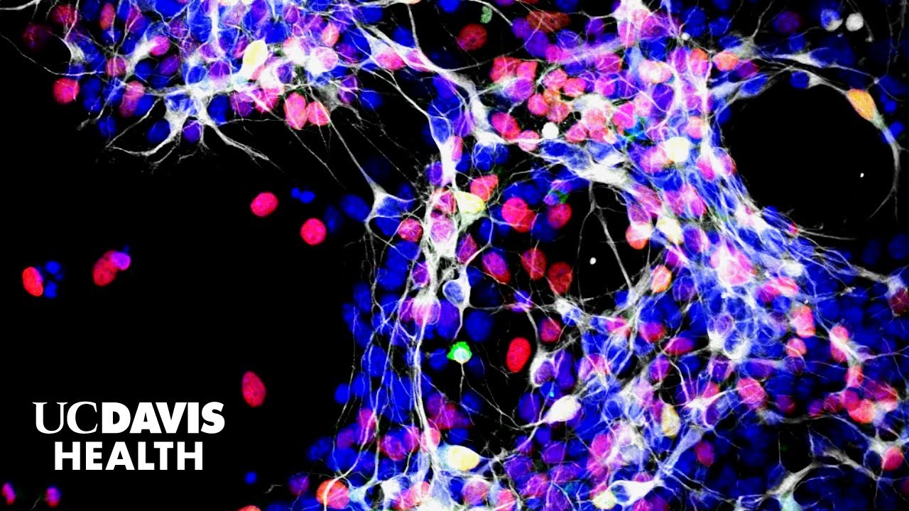 Exploring Stem Cell Treatments for Glaucoma-Related Blindness | UC Davis Health Research