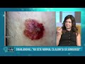 Control Medical 3 Video thumbnail