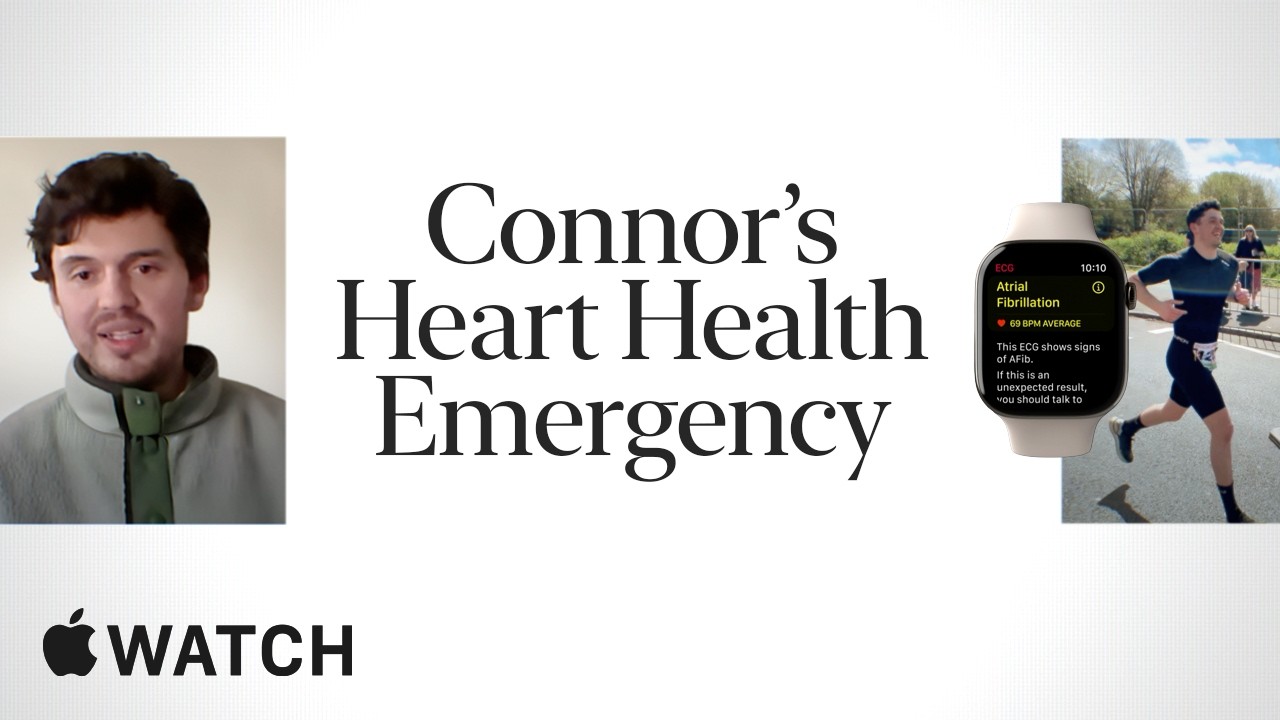 Apple Watch ECG: Connor’s True Apple Watch Story