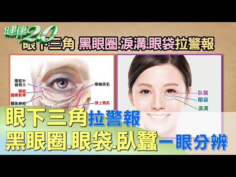 眼袋卧蠶面相