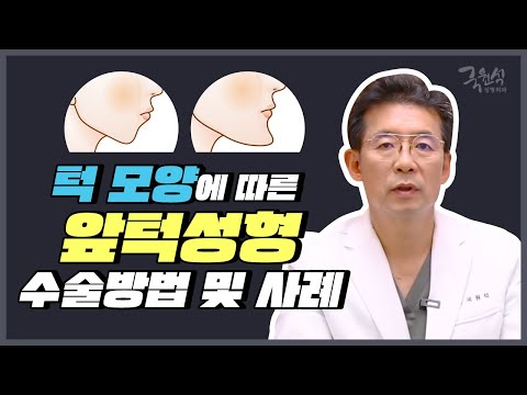 [앞턱성형 총정리 #1] 턱모양에 따른 앞턱성형 수술방법 및 사례
