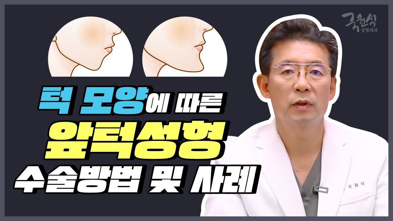 [앞턱성형 총정리 #1] 턱모양에 따른 앞턱성형 수술방법 및 사례 썸네일