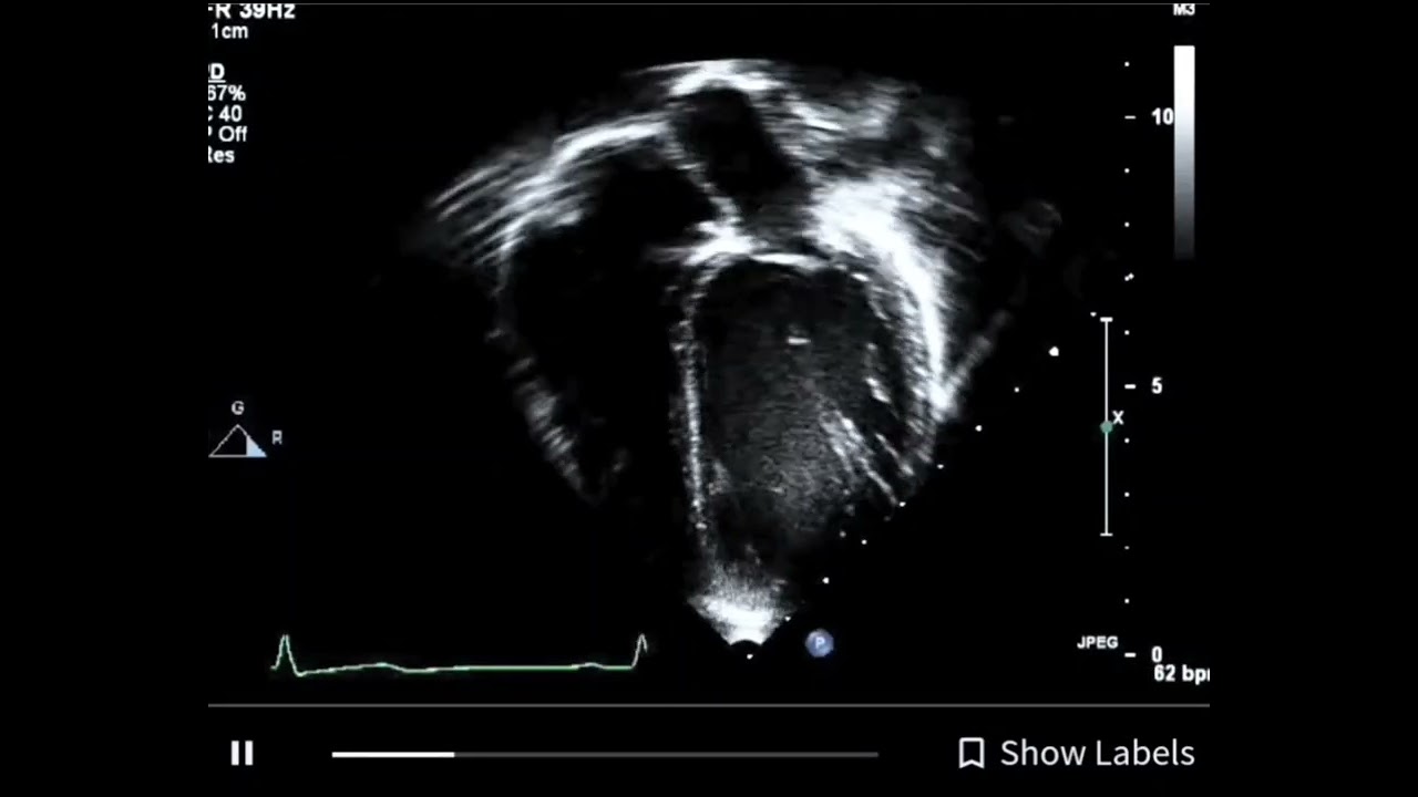 Carlos Mario Balcazar Ochoa-8