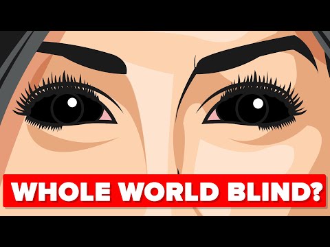 What if The Whole World Suddenly Went Blind?
