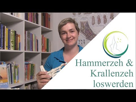 Hammerzeh und Krallenzeh loswerden, podologinandrea