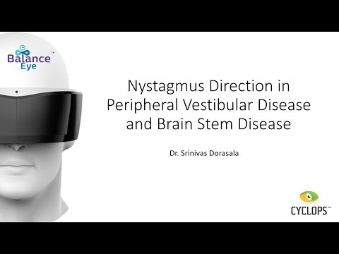Nystagmus Direction in Peripheral Vestibular & Brain Stem Disease