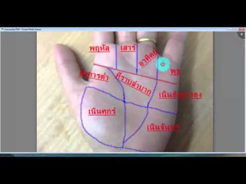 เล็บโภชนาเปลี่ยนแปลงกลาก ความคิดเห็นของกลาก