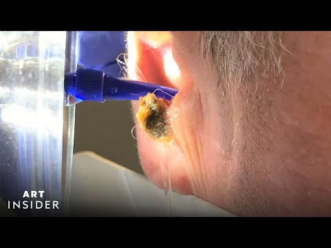 Water Device Painlessly Removes Earwax | Art Insider