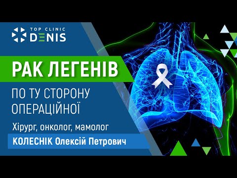 Лечение рака легких – впечатления пациента TOP Clinic DENIS - TOP Clinic DENIS