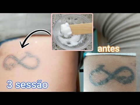 , title : 'COMO REMOVER TATUAGEM EM CASA COM ESFOLIAÇÃO | APENAS 1 INGREDEENTE'