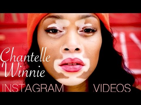 Leffetto di decolorazione per pelle intorno a occhi Klenzit da posti di pigmentary