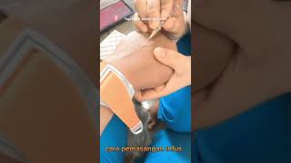 Download lagu tips pemasangan infus mp3 Download lagu tips pemasangan infus mp3