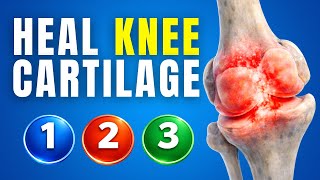 The 3 Most Important Exercise Tips When Repairing Knee Cartilage
