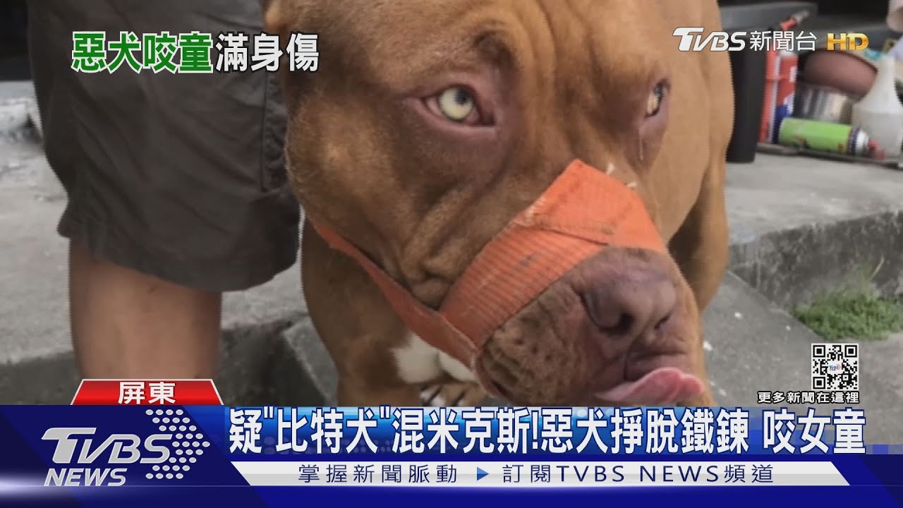 心疼!惡犬攻擊2歲女童 緊咬不放全身40處咬痕