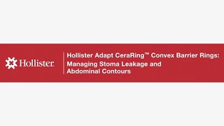 Product video: Hollister 89530 CeraRing Convex Barrier Rings, Round - 1-3/16" (30 mm)