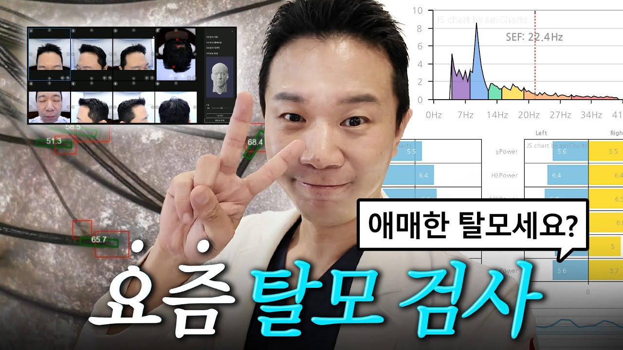 탈모 검사는 어떤 걸 하나요? 낋여왔습니다🔥