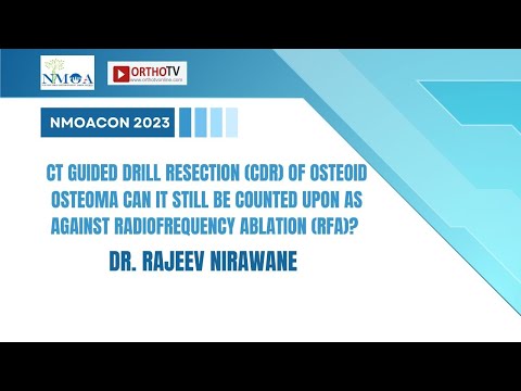 NMOACON 2023: CT Drill Resection vs. RFA for Osteoma - Dr. Rajeev Nirawane