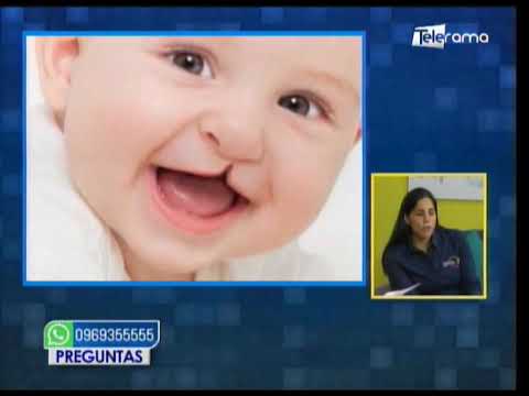 Operación de labio leporino