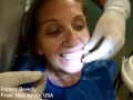 Snap in Dentures. Denture Implants 