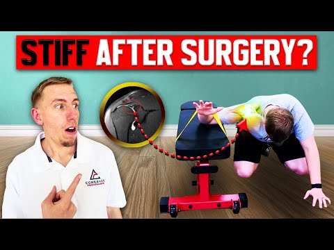 SLAP Tear Surgery But Still Stiff? How To Get Your Shoulder Moving Again Safely