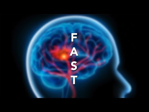 Identifying Signs and Symptoms of Stroke - FAST